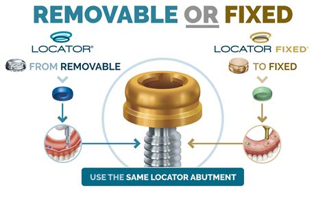 zest metal housing attachments denture|zest implant attachment systems.